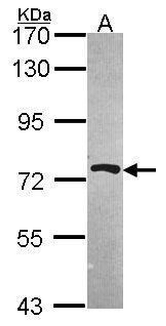 PRMT5 Antibody in Western Blot (WB)