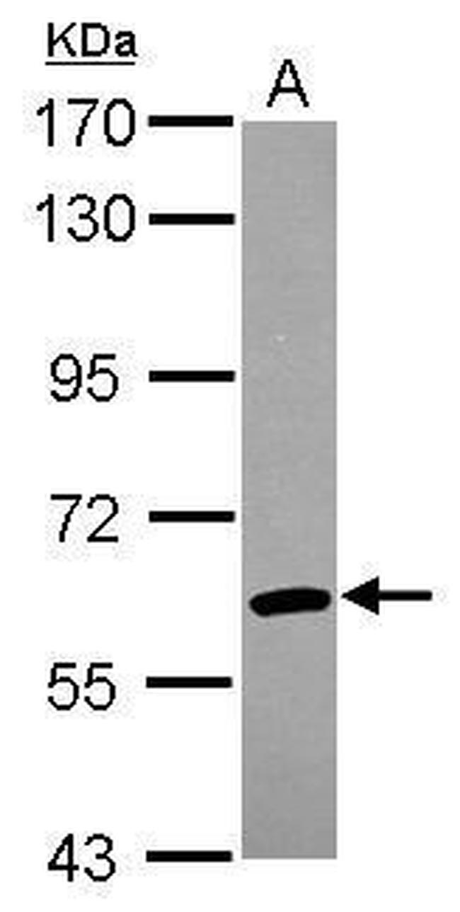 ARIH2 Antibody in Western Blot (WB)