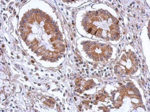 SCGN Antibody in Immunohistochemistry (Paraffin) (IHC (P))