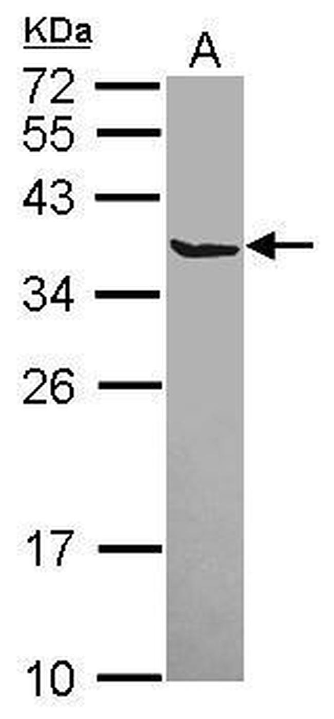 SCGN Antibody in Western Blot (WB)