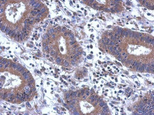 SCGN Antibody in Immunohistochemistry (Paraffin) (IHC (P))