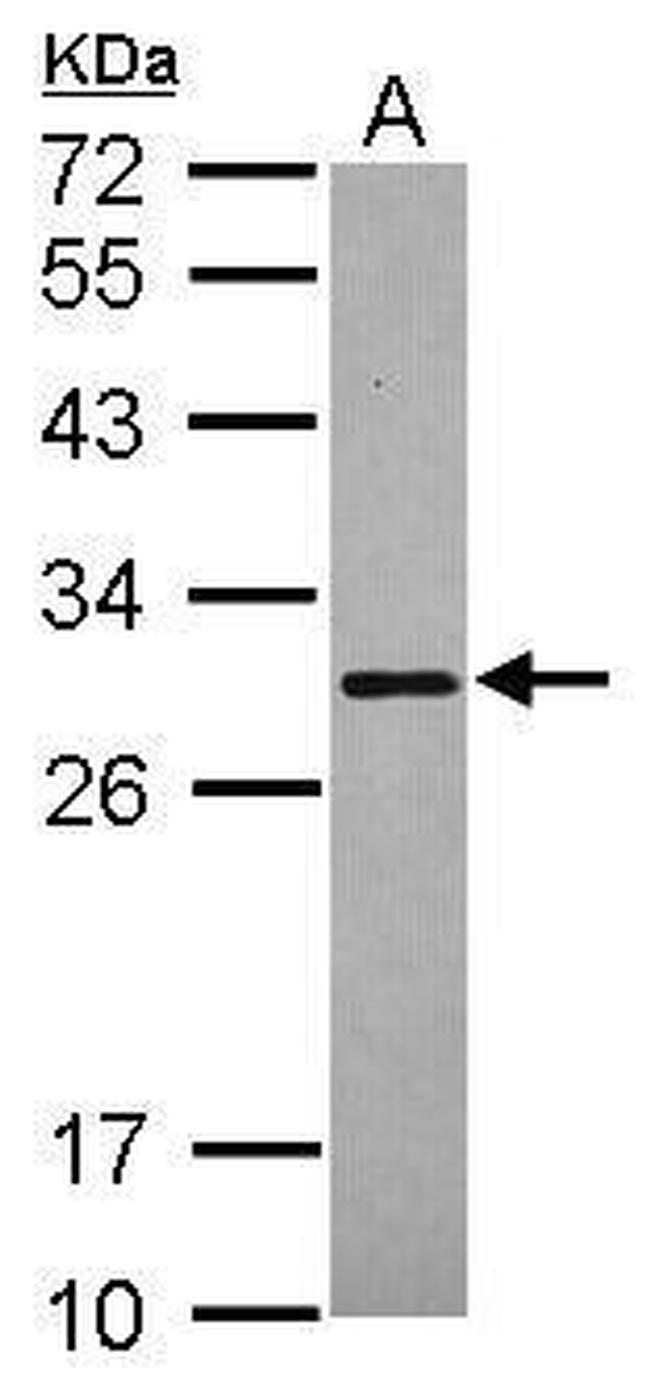 SCGN Antibody in Western Blot (WB)