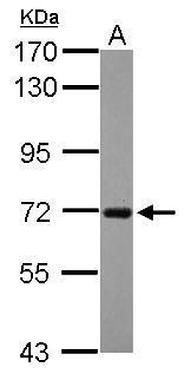 RGS14 Antibody in Western Blot (WB)