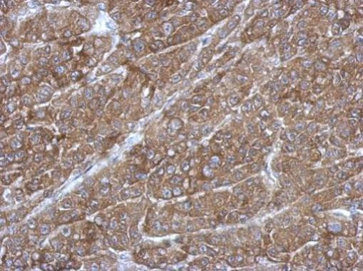 RGS14 Antibody in Immunohistochemistry (Paraffin) (IHC (P))