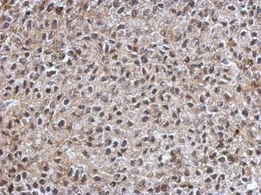 IGF2BP3 Antibody in Immunohistochemistry (Paraffin) (IHC (P))