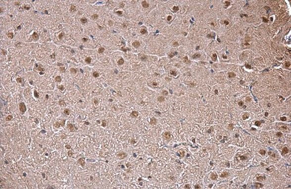 SAM68 Antibody in Immunohistochemistry (Paraffin) (IHC (P))