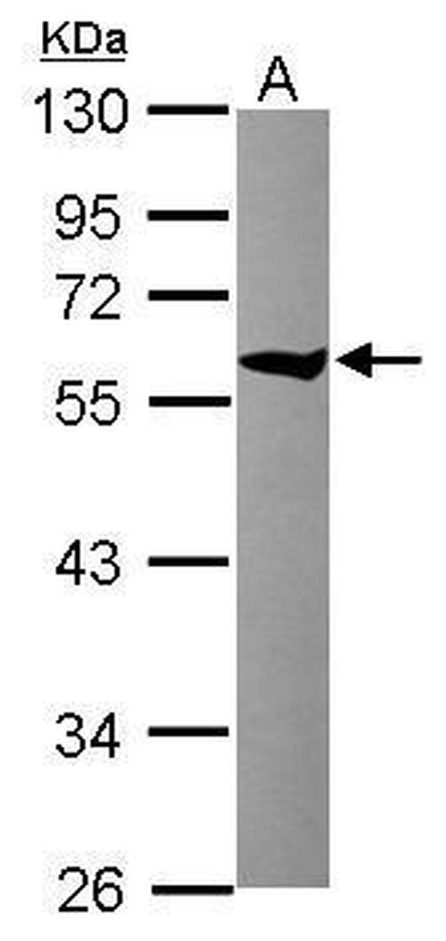 TCP-1 theta Antibody in Western Blot (WB)