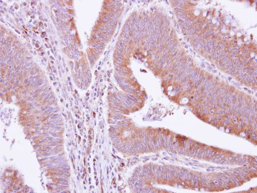 GRAP Antibody in Immunohistochemistry (Paraffin) (IHC (P))