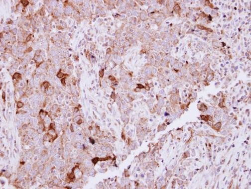 NCKAP1 Antibody in Immunohistochemistry (Paraffin) (IHC (P))