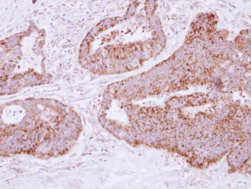 MTHFD2 Antibody in Immunohistochemistry (Paraffin) (IHC (P))