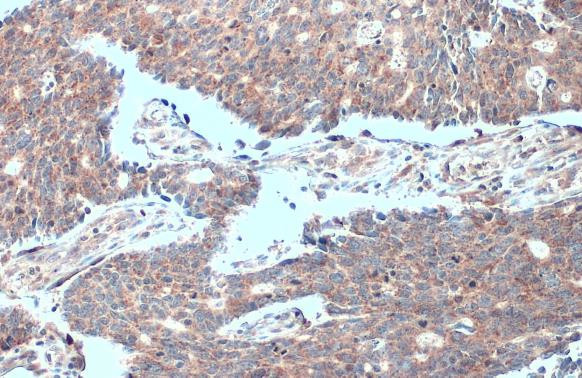 MTHFD2 Antibody in Immunohistochemistry (Paraffin) (IHC (P))