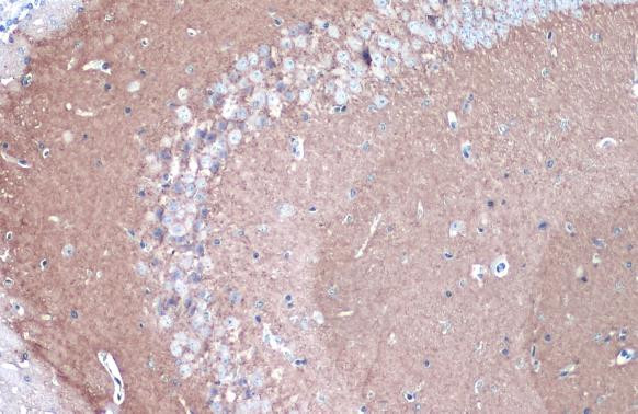 CYP46A1 Antibody in Immunohistochemistry (Paraffin) (IHC (P))