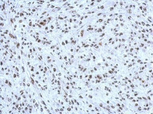 HP1 beta Antibody in Immunohistochemistry (Paraffin) (IHC (P))