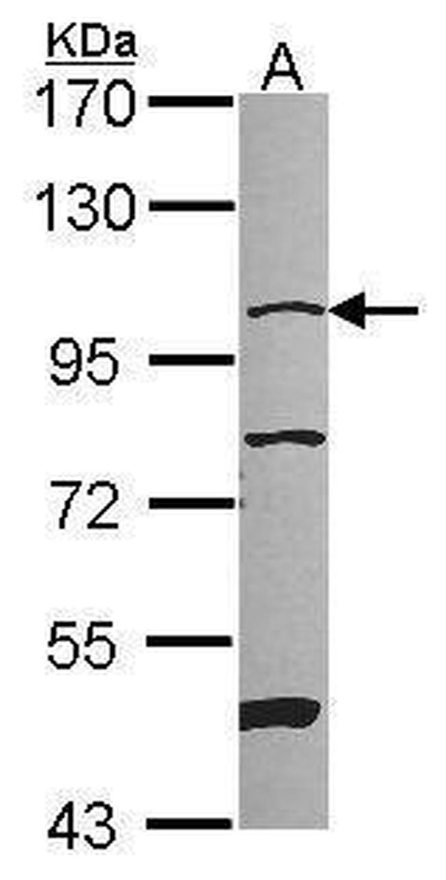 NAA15 Antibody in Western Blot (WB)