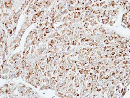 DUSP10 Antibody in Immunohistochemistry (Paraffin) (IHC (P))