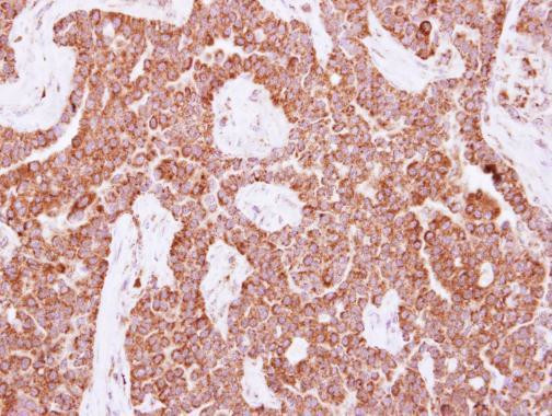 NUDT3 Antibody in Immunohistochemistry (Paraffin) (IHC (P))