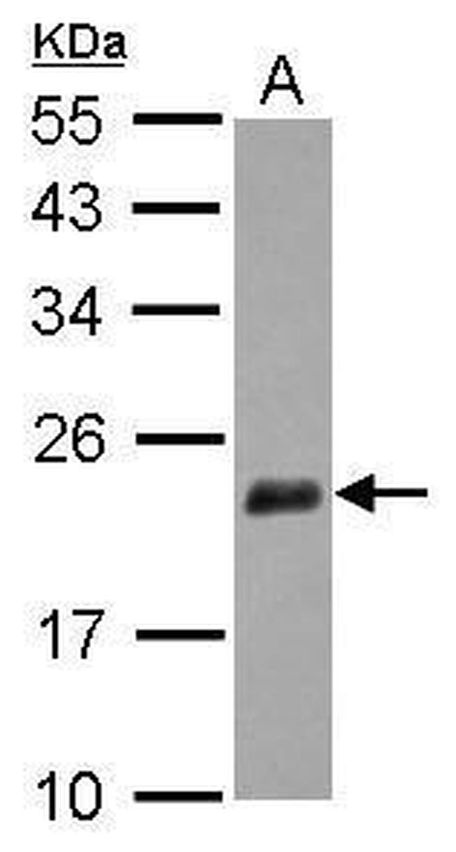 NUDT3 Antibody in Western Blot (WB)