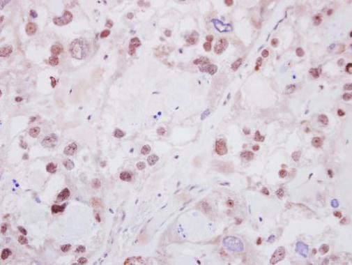 HELIOS Antibody in Immunohistochemistry (Paraffin) (IHC (P))