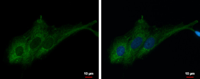 RASA3 Antibody in Immunocytochemistry (ICC/IF)