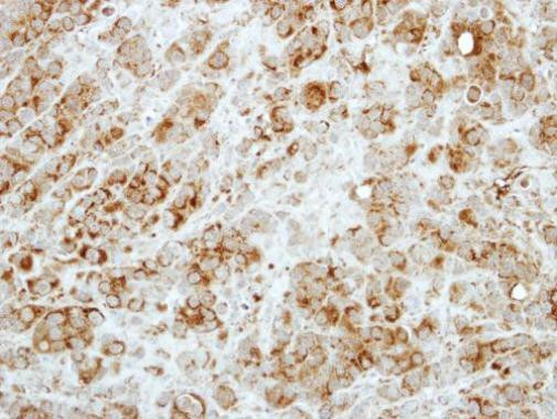 RASA3 Antibody in Immunohistochemistry (Paraffin) (IHC (P))