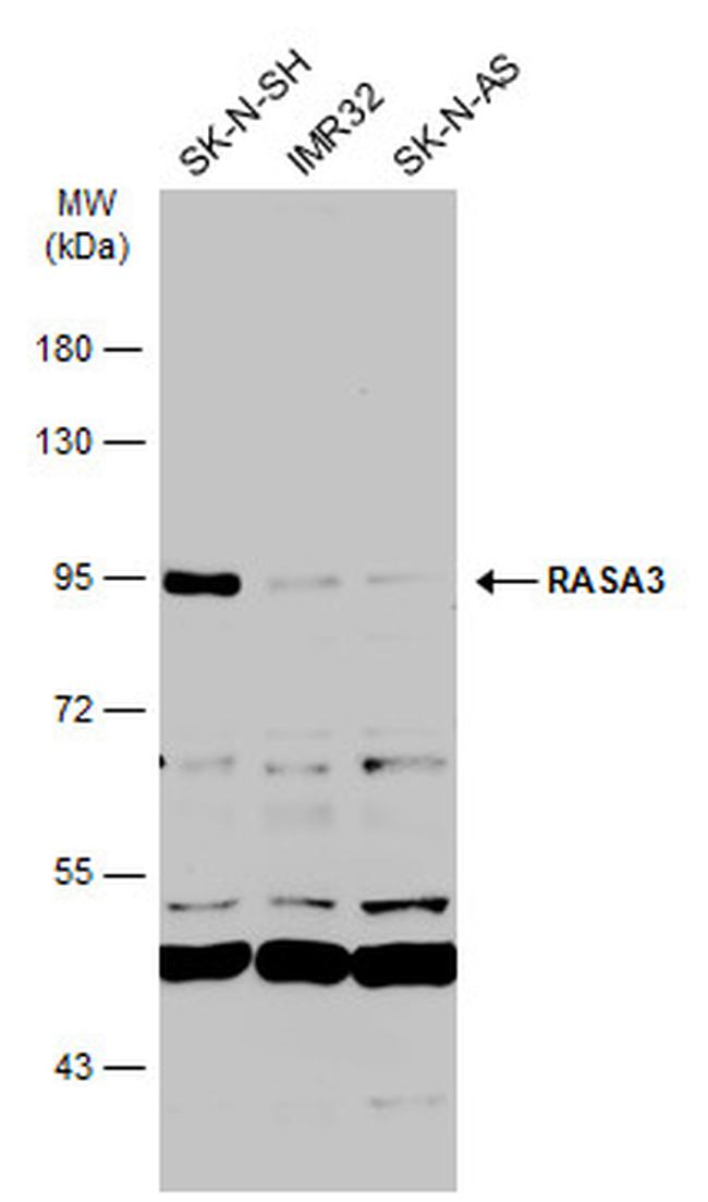 RASA3 Antibody in Western Blot (WB)