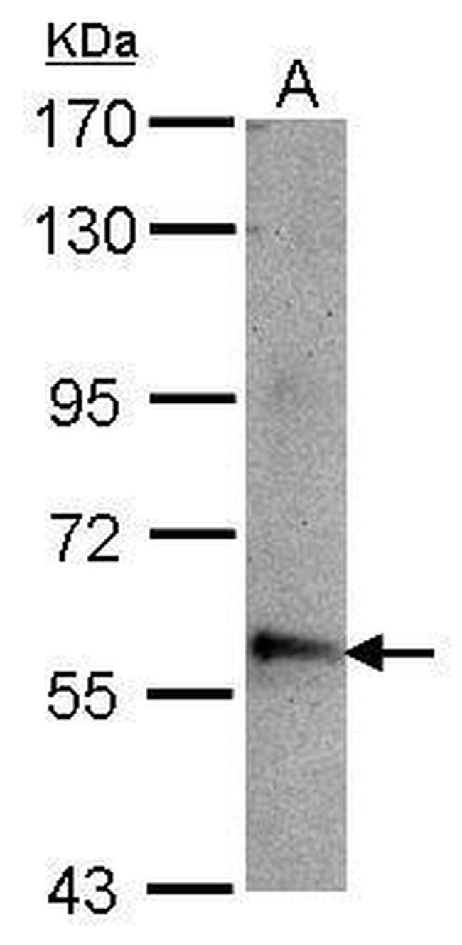 ABLIM3 Antibody in Western Blot (WB)