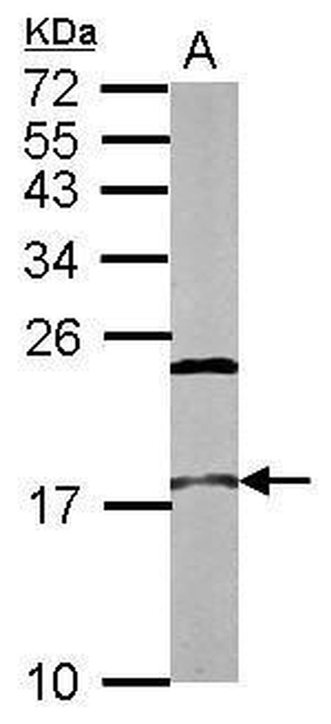 NCBP2 Antibody in Western Blot (WB)