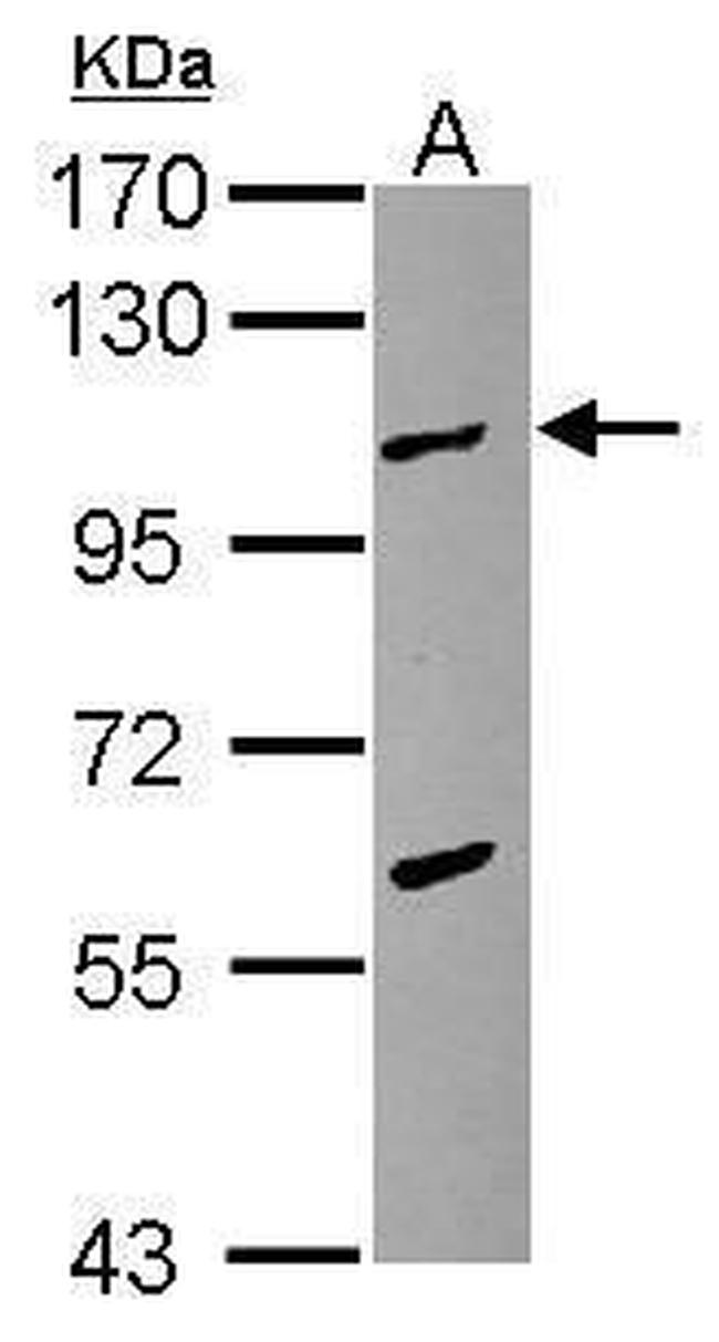 TPX2 Antibody in Western Blot (WB)