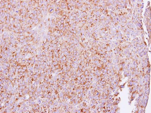 ETEA Antibody in Immunohistochemistry (Paraffin) (IHC (P))