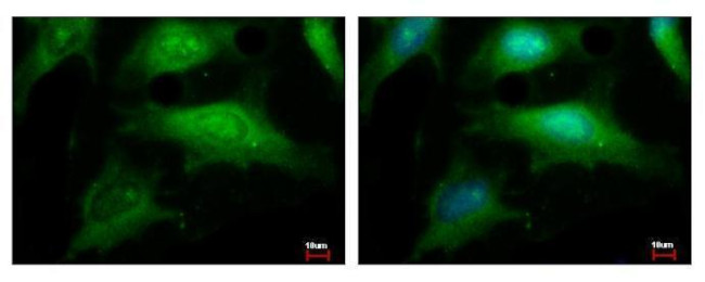 NCAPH Antibody in Immunocytochemistry (ICC/IF)