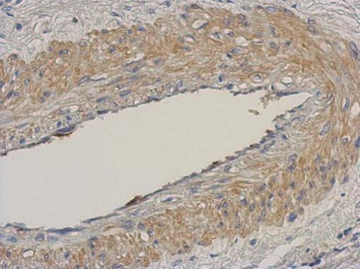 NCAPH Antibody in Immunohistochemistry (Paraffin) (IHC (P))