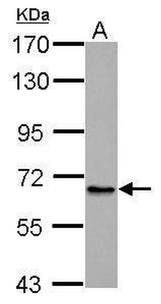 ABCB10 Antibody in Western Blot (WB)