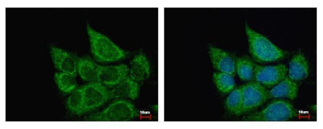 ETHE1 Antibody in Immunocytochemistry (ICC/IF)