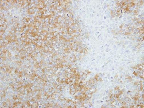 SEC14L2 Antibody in Immunohistochemistry (Paraffin) (IHC (P))