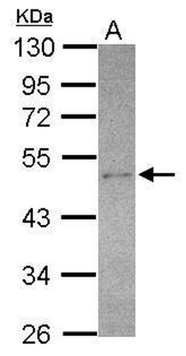 SEC14L2 Antibody in Western Blot (WB)