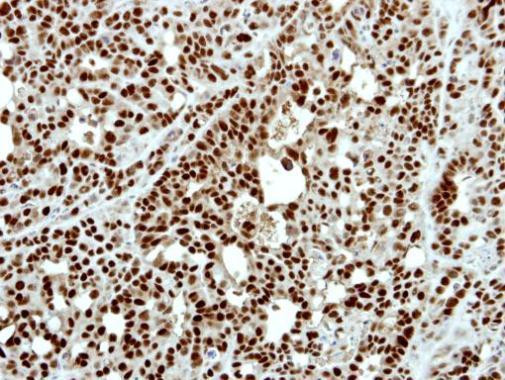 PATZ1 Antibody in Immunohistochemistry (Paraffin) (IHC (P))