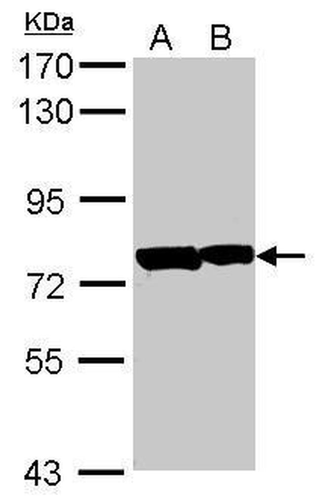 PATZ1 Antibody in Western Blot (WB)