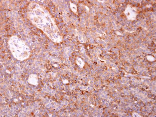 Coronin 3 Antibody in Immunohistochemistry (Paraffin) (IHC (P))