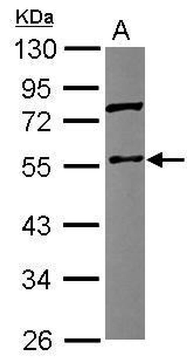 Coronin 3 Antibody in Western Blot (WB)