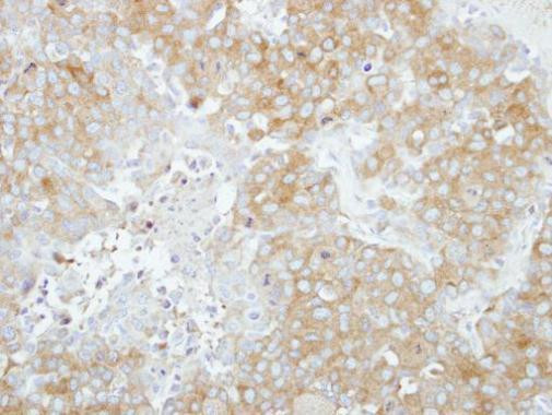 RABGAP1 Antibody in Immunohistochemistry (Paraffin) (IHC (P))