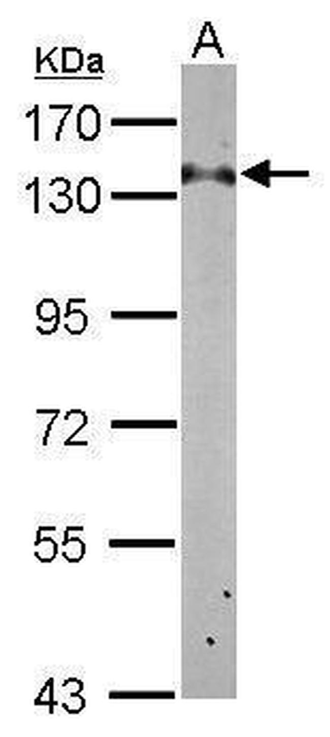 RABGAP1 Antibody in Western Blot (WB)