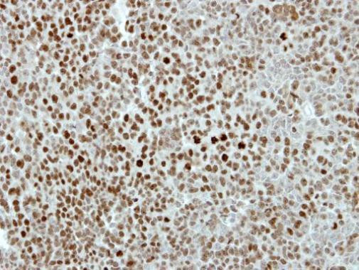 KIF4A Antibody in Immunohistochemistry (Paraffin) (IHC (P))