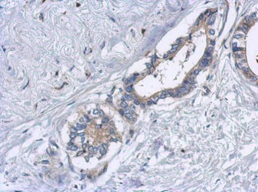 EML2 Antibody in Immunohistochemistry (Paraffin) (IHC (P))