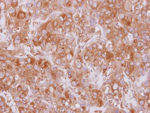 EML2 Antibody in Immunohistochemistry (Paraffin) (IHC (P))