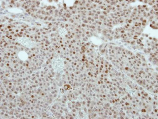 CREST Antibody in Immunohistochemistry (Paraffin) (IHC (P))