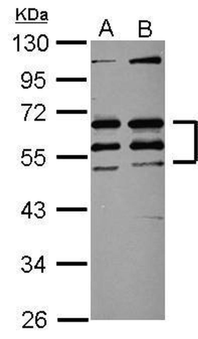 CREST Antibody in Western Blot (WB)