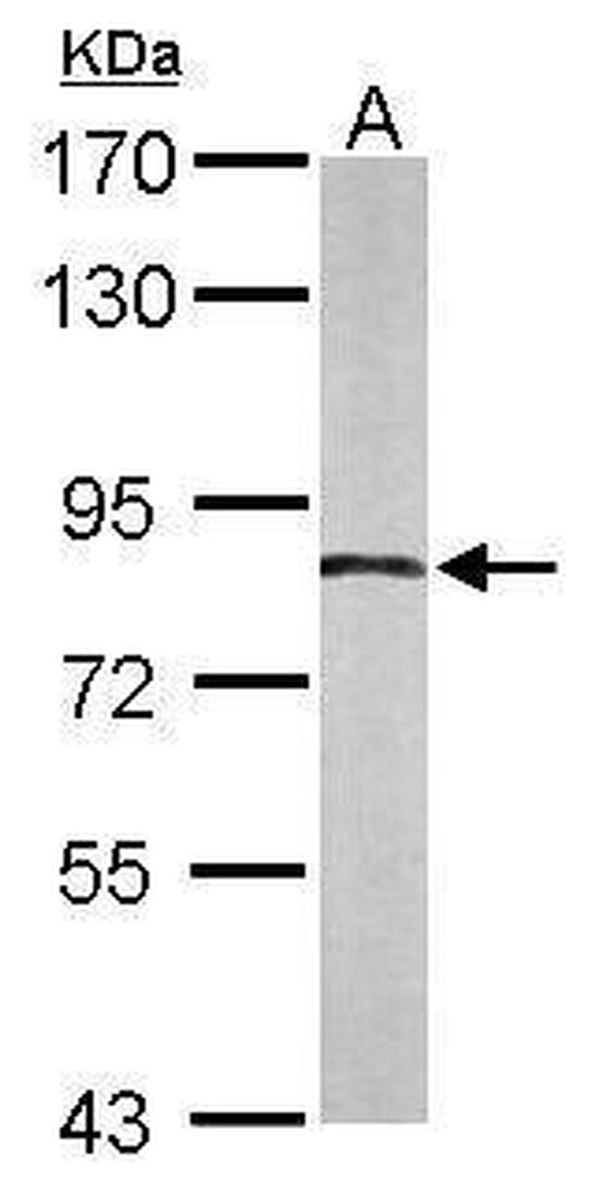 APPL1 Antibody in Western Blot (WB)