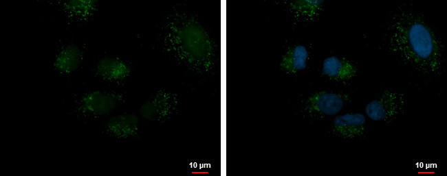 DECR2 Antibody in Immunocytochemistry (ICC/IF)