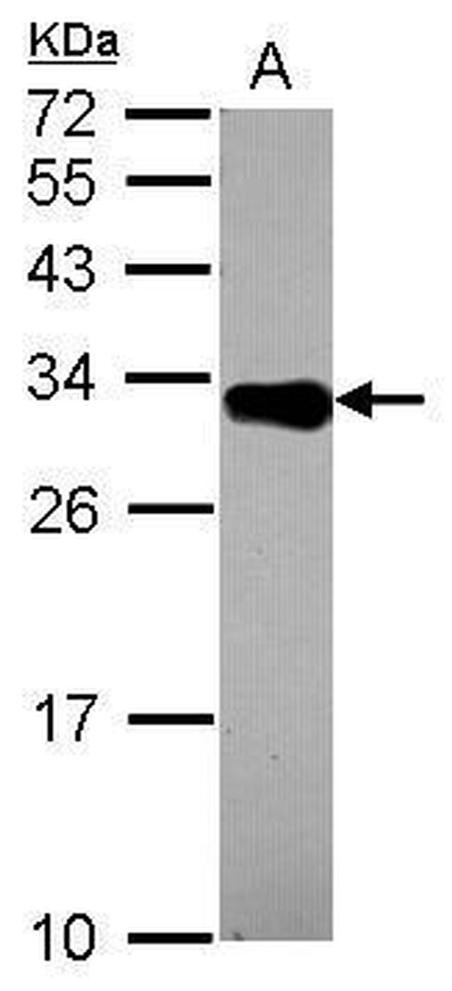 DECR2 Antibody in Western Blot (WB)