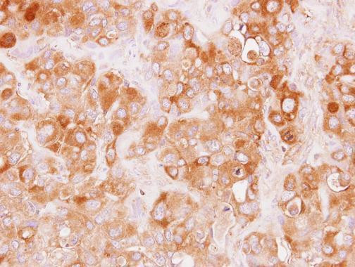 TRAF3IP1 Antibody in Immunohistochemistry (Paraffin) (IHC (P))